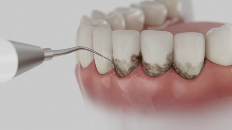 Trusted Tooth Extraction service in Rich Hill, MO - Dentist Open Now
